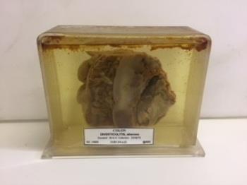 LARGE INTESTINE, colon